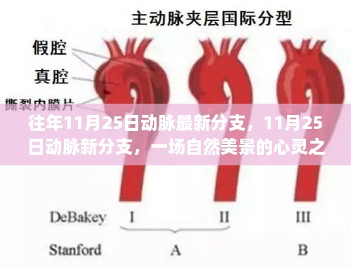 往年11月25日動脈最新分支，11月25日動脈新分支，一場自然美景的心靈之旅