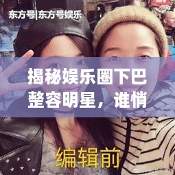 揭秘娛樂圈下巴整容明星，誰悄悄整過下巴？