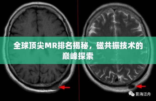 全球頂尖MR排名揭秘，磁共振技術(shù)的巔峰探索